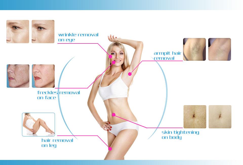 IPL SHR Machine For Clinic & Professional Use