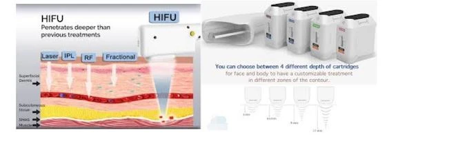 4D HIFU face lifting machine 